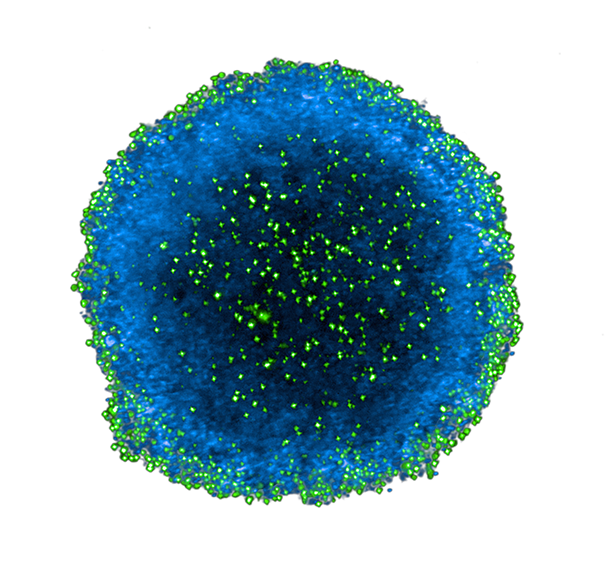 plasmactcell